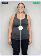 Side-by-side comparison of a patient at month 0 and month 12 of a weight loss protocol